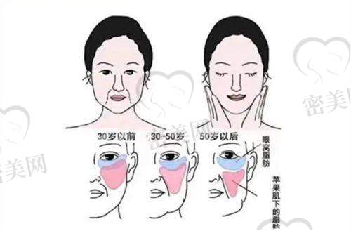 小贴士:做双眼皮前后有哪些注意事项?