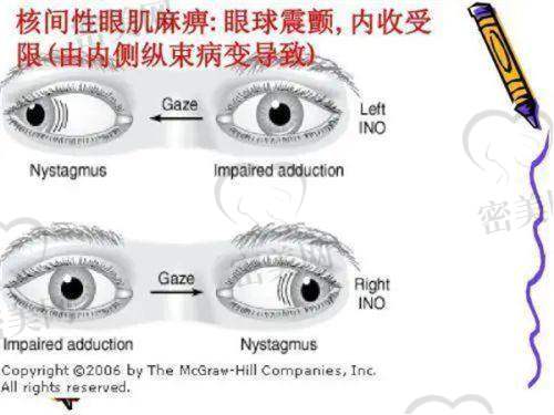 眼科项目医疗保险报销政策+注意事项