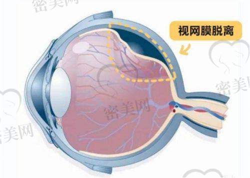 合肥东南眼科医院值得信赖吗？
