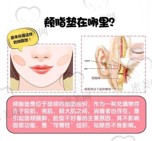 南宁韩成整形做隆胸怎么样？口碑好的医生是谁？