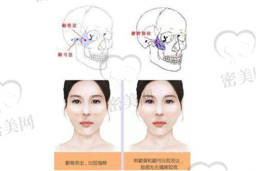 张蔚萱医生:女性私密&产后修复技术不错