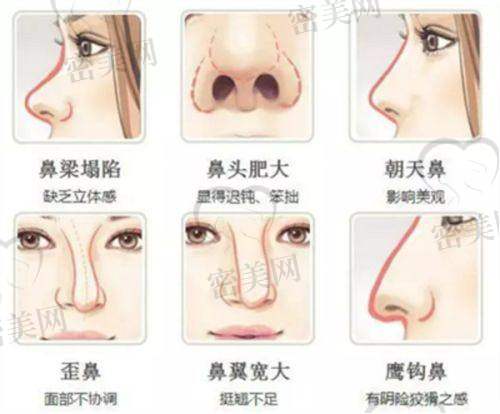 真实反馈+人气口碑：为什么大家都找王博谦?