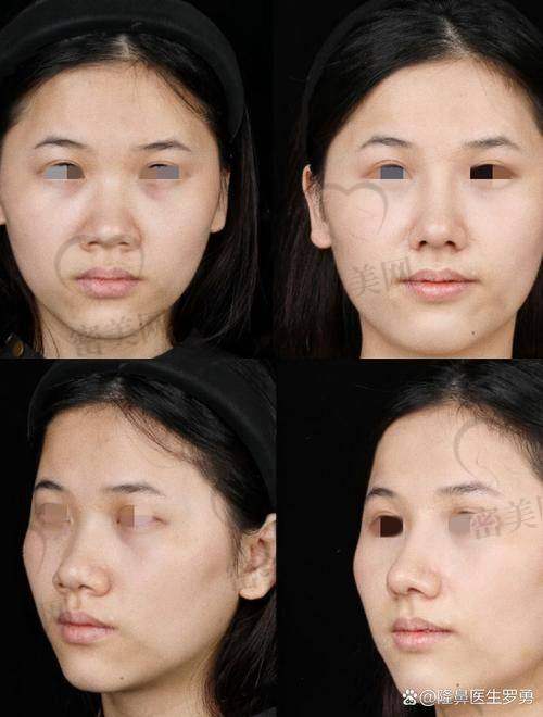 天津时光整形宋爱华：20000元起的美鼻“白菜价”