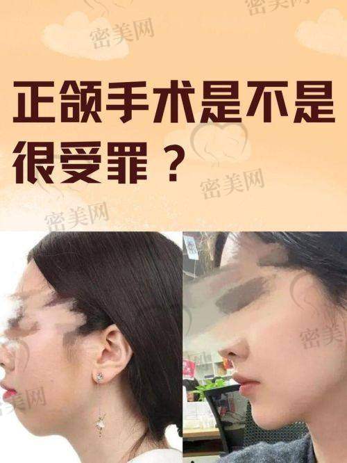 广州艾伟健正颌手术价格表详细剖析：5-13万到底怎么计算的？