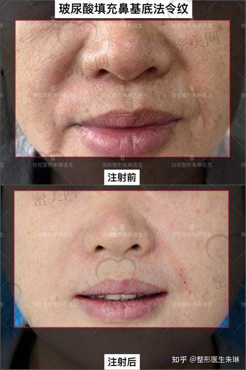 30岁女性整形项目