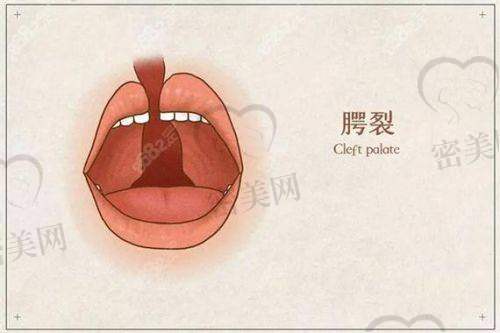 手术进行时：紧张又期待