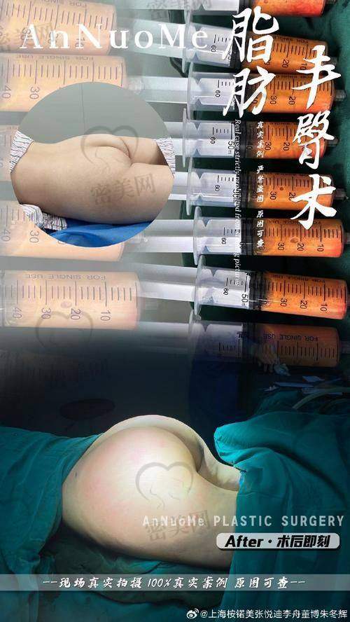 热门整形医院活动汇总