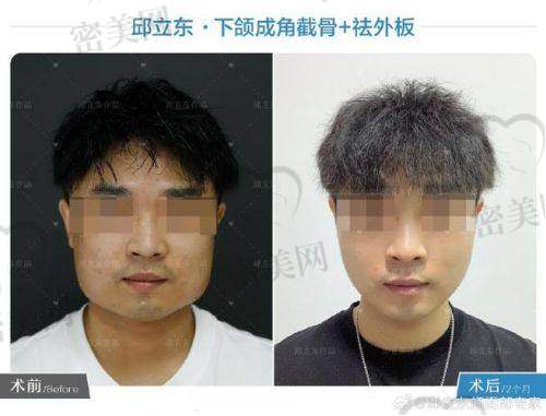 李继华磨骨技术怎么样？有哪些技术优势？