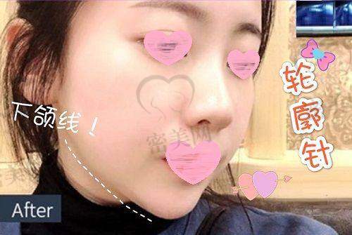 西安美合未央店医生信息总览一览表