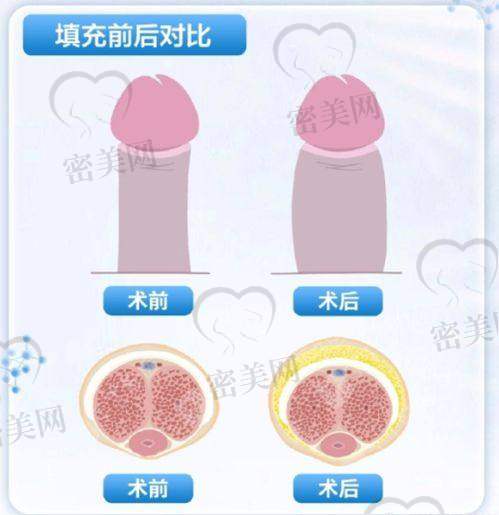 实战实例展示：佛山禅城中 心医院正颌改善到底有哪些改变？