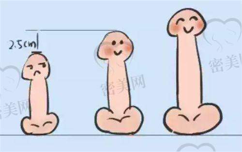 选择建议