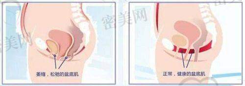 擅长项目