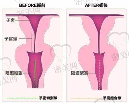 成都画美医疗美容医院怎么预约挂号？