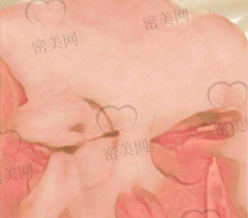 3. 上海时光医疗美容医院：轮廓整形的实力角色