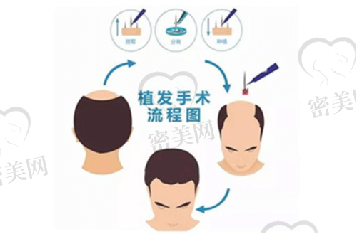 刘裴华医生坐诊，种植技术实力派代表