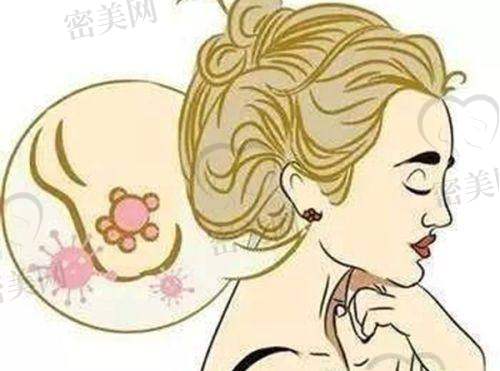南方医 科 大学南方医院整形外科：实用省钱技巧整理