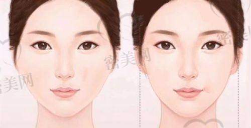 成都画美医疗美容医院口碑怎么样？
