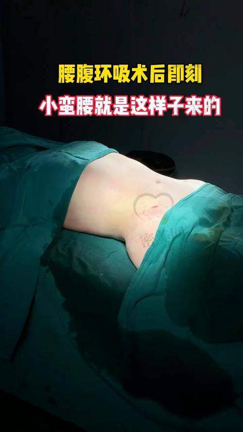 王彬医生的吸脂技术，绝了！