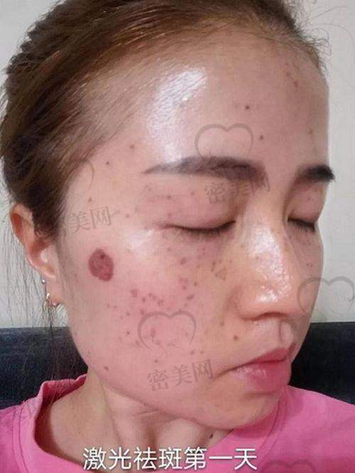 大同德尔美客医疗美容医院：操作专精，治疗顾问把关更放心