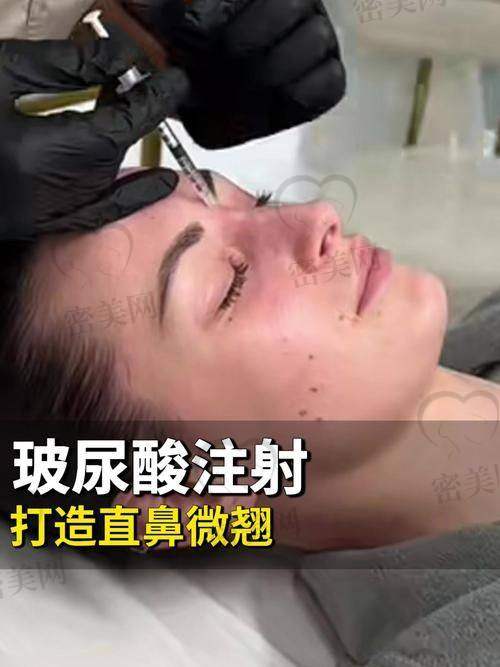 整形医院活动与玻尿酸价格的影响