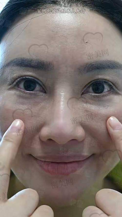 手术过程，紧张又期待