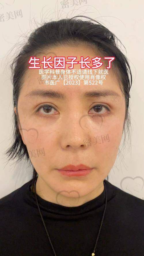 术后修复，惊喜不断