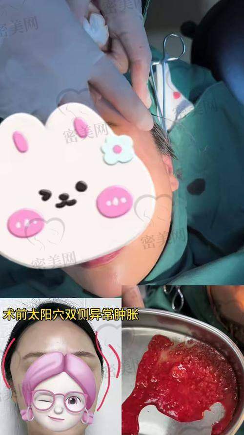 手术体验，像坐过山车