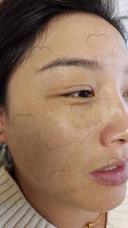 沈阳悠美医疗美容医院：冷敷美肤理念