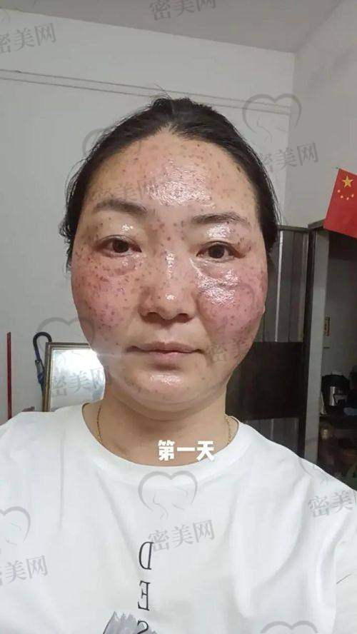 沈阳百嘉丽医疗美容医院：中胚层美塑独特优势