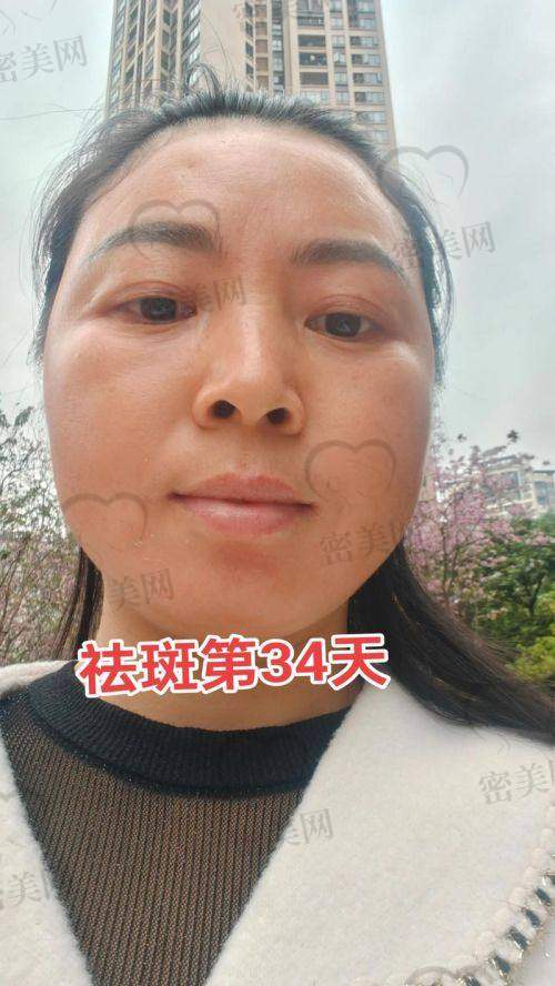 沈阳伊美尔整形美容医院：细胞级肌底激活模式