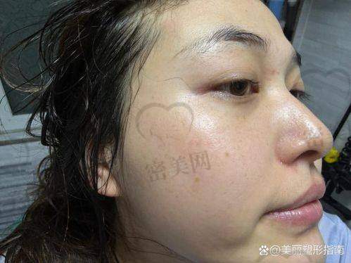 沈阳维多利亚医疗美容医院：系统化诊前评估