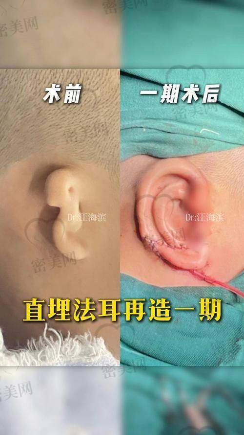 成都八大处医美西 南旗舰院：3D个性定制耳再造医疗中 心