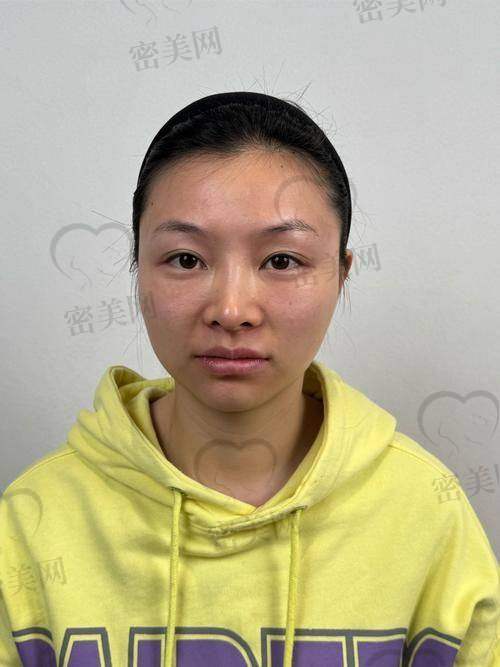 伊妍仕少女针