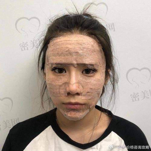 濡白天使