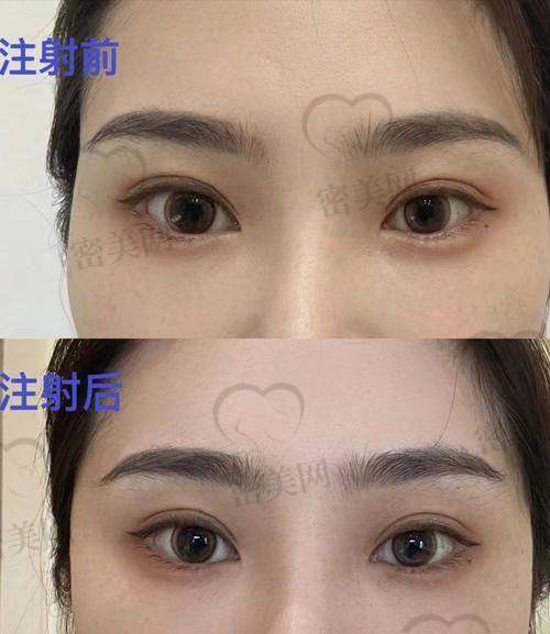 整形攻略