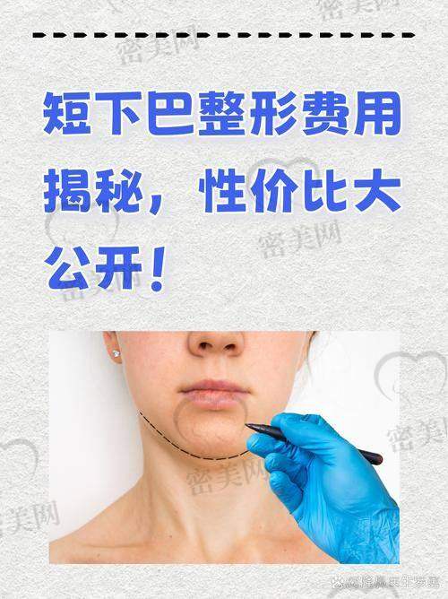 术前注意事项