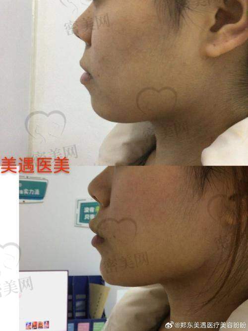 手术时长及过程