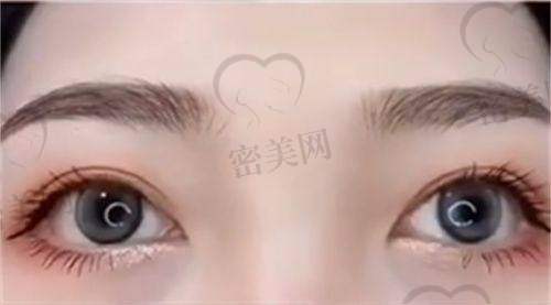 惠州韩美整形：韩系玻尿酸与精致线提升并驾齐驱