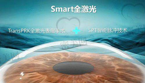 兰州全飞秒激光手术价格对比表