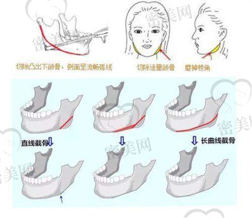 1. 潍坊星遇医疗美容医院