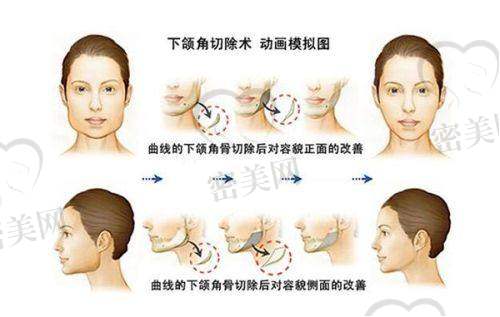 曹林医生抖音号怎么找？粉丝关注攻略请收好