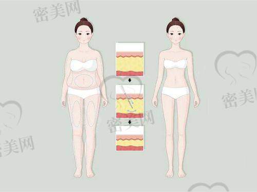 【邱凯杨医生擅长项目】