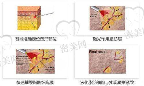 大理伊美东方丽人医疗美容诊所怎么样？