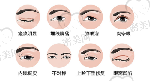 深圳鹏程整形医院：设备精良，鼻眼胸领域都拿得出手