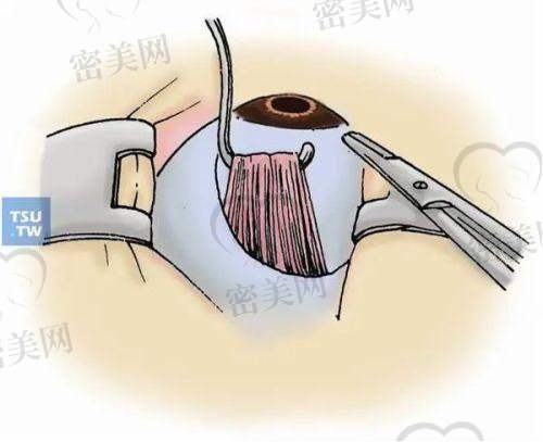 温州中 国眼谷超级眼视光医院价格表：