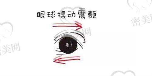 全飞秒手术适合哪类人群？手术流程简单概览