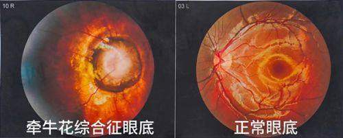 包头朝聚眼科医院出诊：呼包鄂患者福音，节省跨省奔波