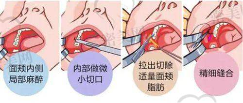 大理伊美东方丽人医疗美容诊所口碑怎么样？