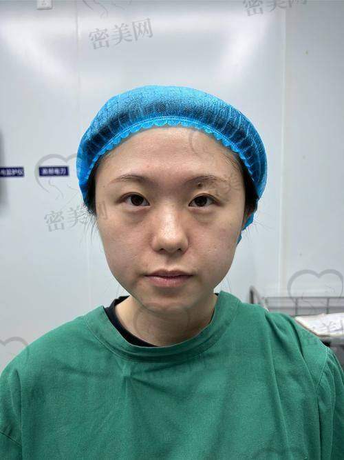 王衡健医生开内眼角做开扇手术口碑咋样？群众说了算
