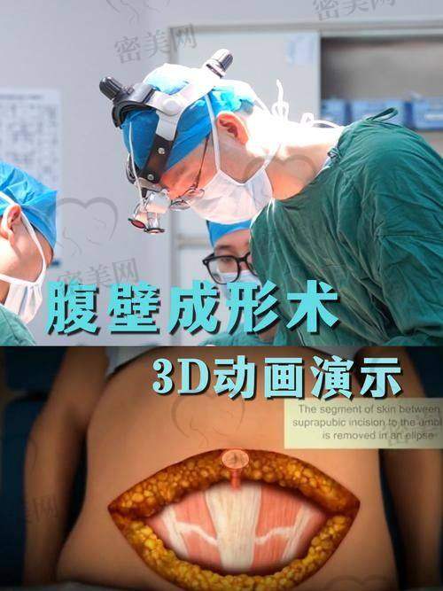 术前准备：紧张又期待的小忐忑